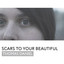 Thomas Daniel - Scars To Your Beautiful